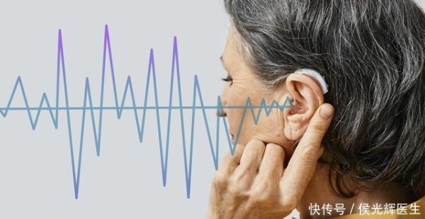 我要配资 花掉3万元，给老人换过5个助听器后，这些教训和启示不吐不快